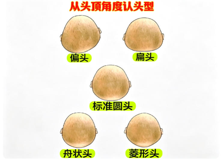 韩国颅骨缩小整形哪家好？2026 选院先看资质与风险答疑